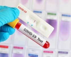 За две недели ќе се набават брзите тестови за Ковид 19, а  ќе чинат 800 денари – резултат за 15 минути